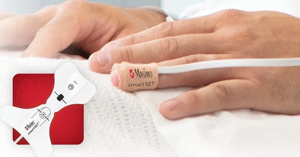 FDA-engedélyt kapott a Masimo pulzoximéteres AFib-felismerése