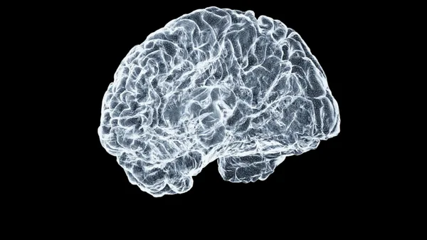 Nyílt forrású AI-eszközökkel gyorsítaná a demenciakutatást a C-BRAIN